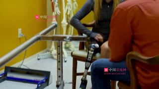 假肢计师为残疾美女量身设计义肢
